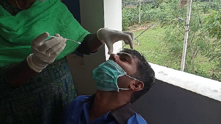 Testing of COVID-19 Virus